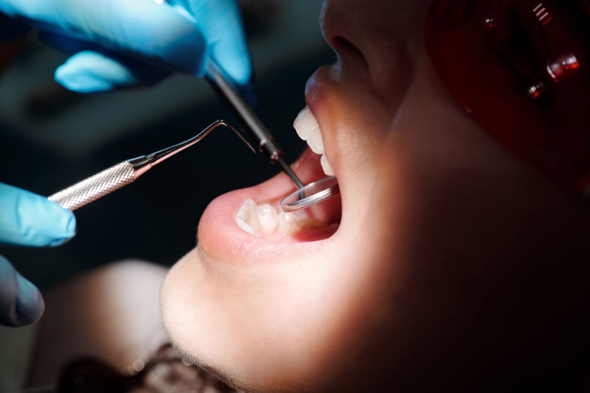 How Long Do Porcelain Veneers Actually Last