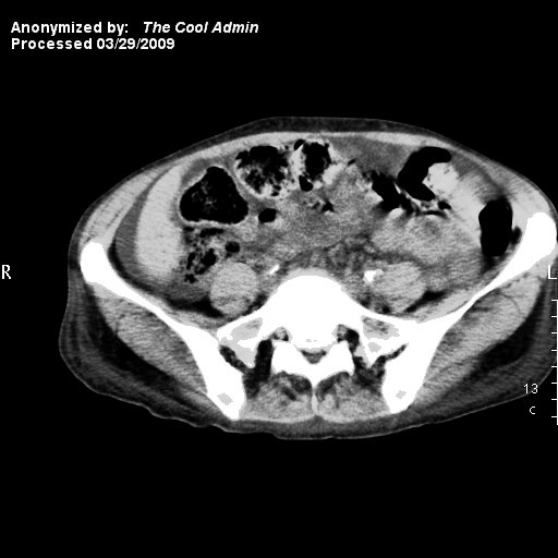 Github Dicom Ruby Dicom Library For Reading Editing And Writing - Perfect 8K Sunset Wallpapers | Free Download