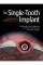 The Single-Tooth Implant: A Minimally Invasive Approach for Anterior and Posterior Extraction Sockets 1st Edition 2 The Single-Tooth Implant: A Minimally Invasive Approach for Anterior and Posterior Extraction Sockets 1st Edition