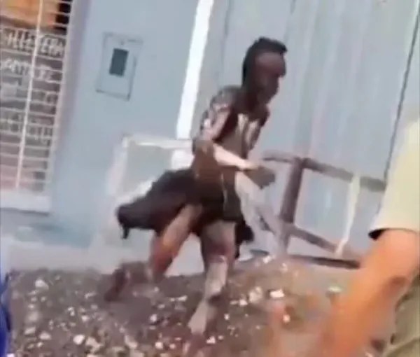 Quiso robar cables de alta tensión y terminó con el 90% del cuerpo quemado