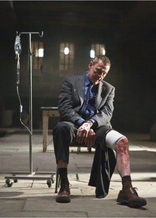 A man in a suit sits on a chair, holding his injured leg with visible wounds. He looks weary and distressed. An IV stand is next to him in a dimly lit room with a stone floor and barred windows.