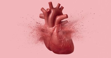 “Broken heart syndrome” can look just like a heart attack. This test can tell them apart