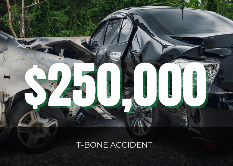 Real DIG Law case result  - T-bone accident