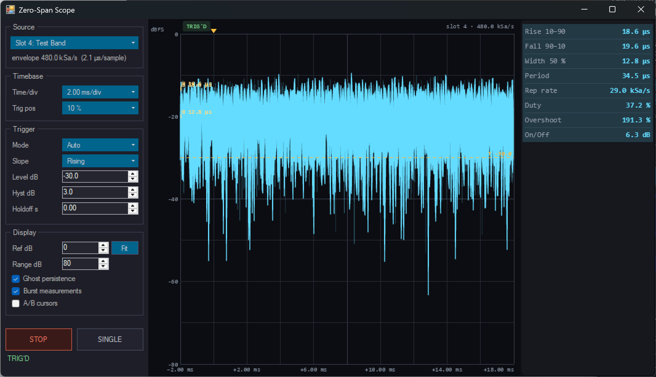 Lab Zero-Span Scope window