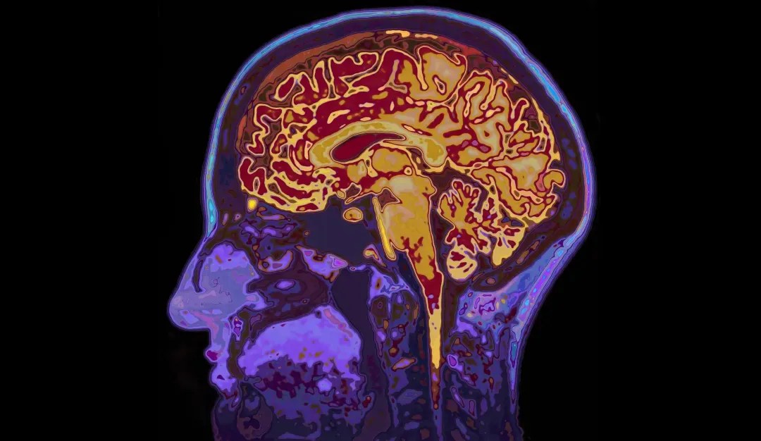 Choroba Alzheimera wchodzi w nową erę. Naukowcy mówią o leczeniu i ograniczaniu ryzyka