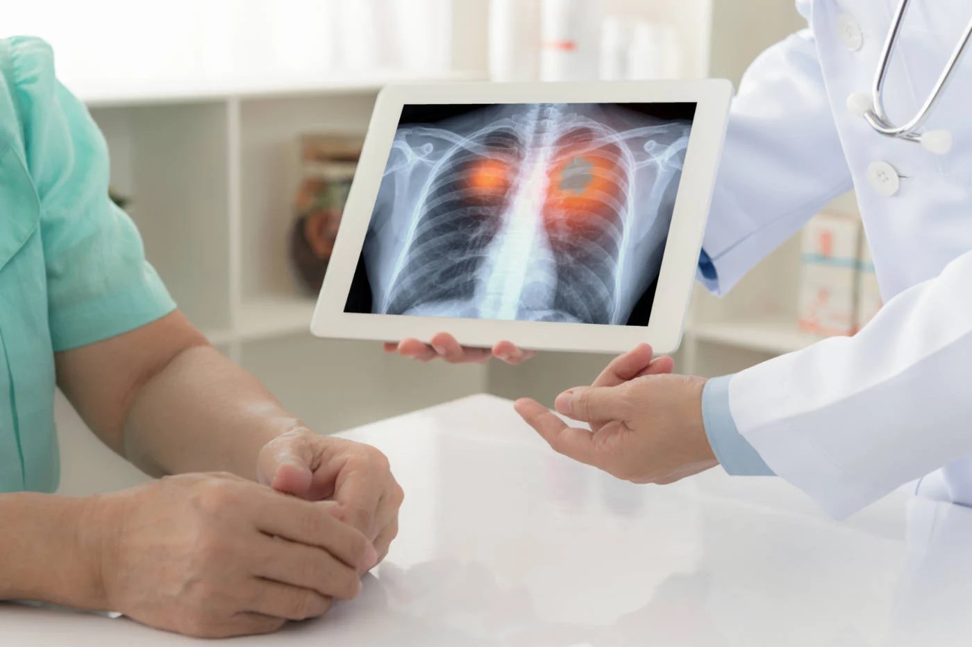 În ultimele zile înainte de moartea sa, o persoană observă adesea imagini . Hiperprogresia Cancerului Pulmonar FÄrÄ Celule Mici In Contextul Imunoterapiei