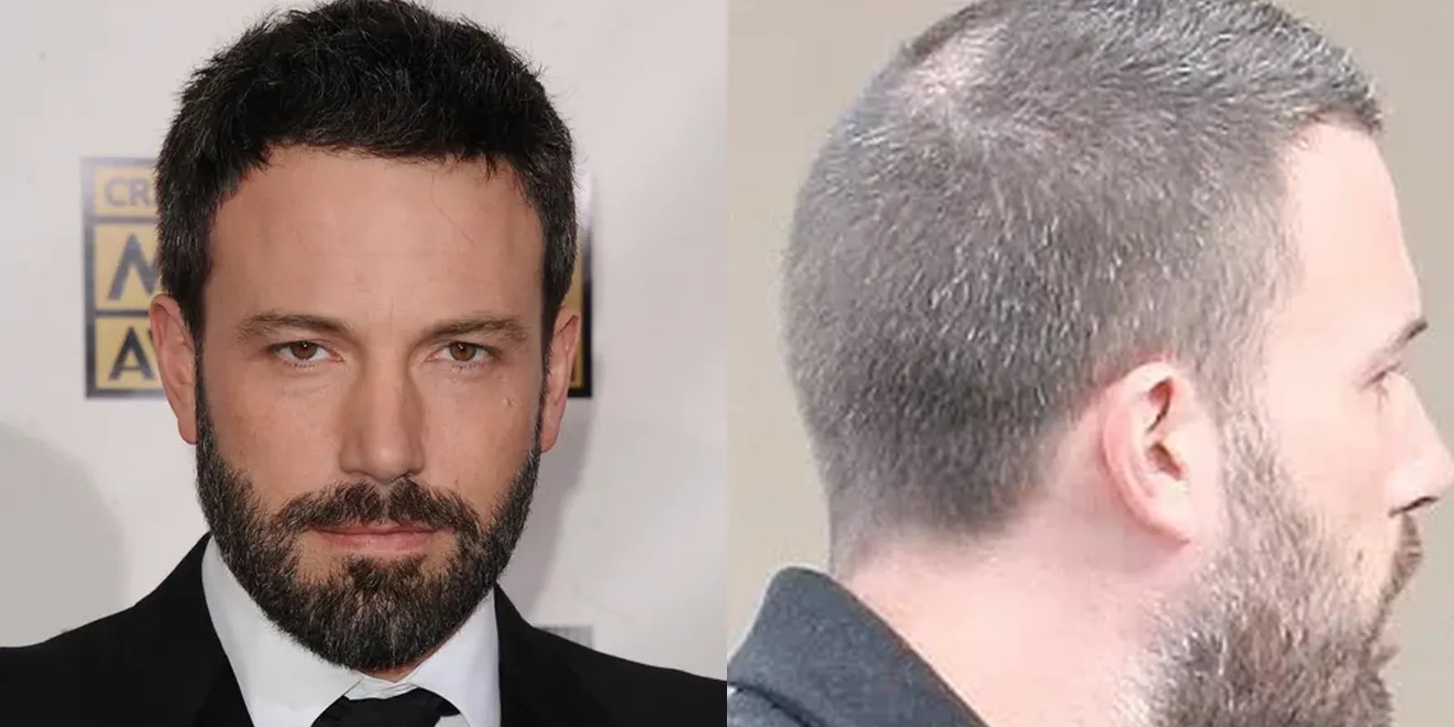 Ben affleck hair: is he bald or wearing a toupee?