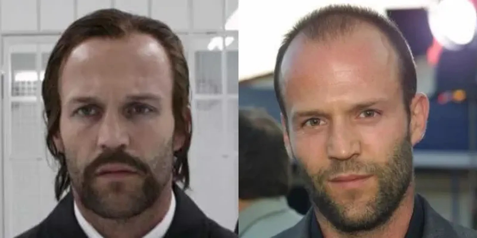 Unlocking the mystery of jason statham's hair transplant