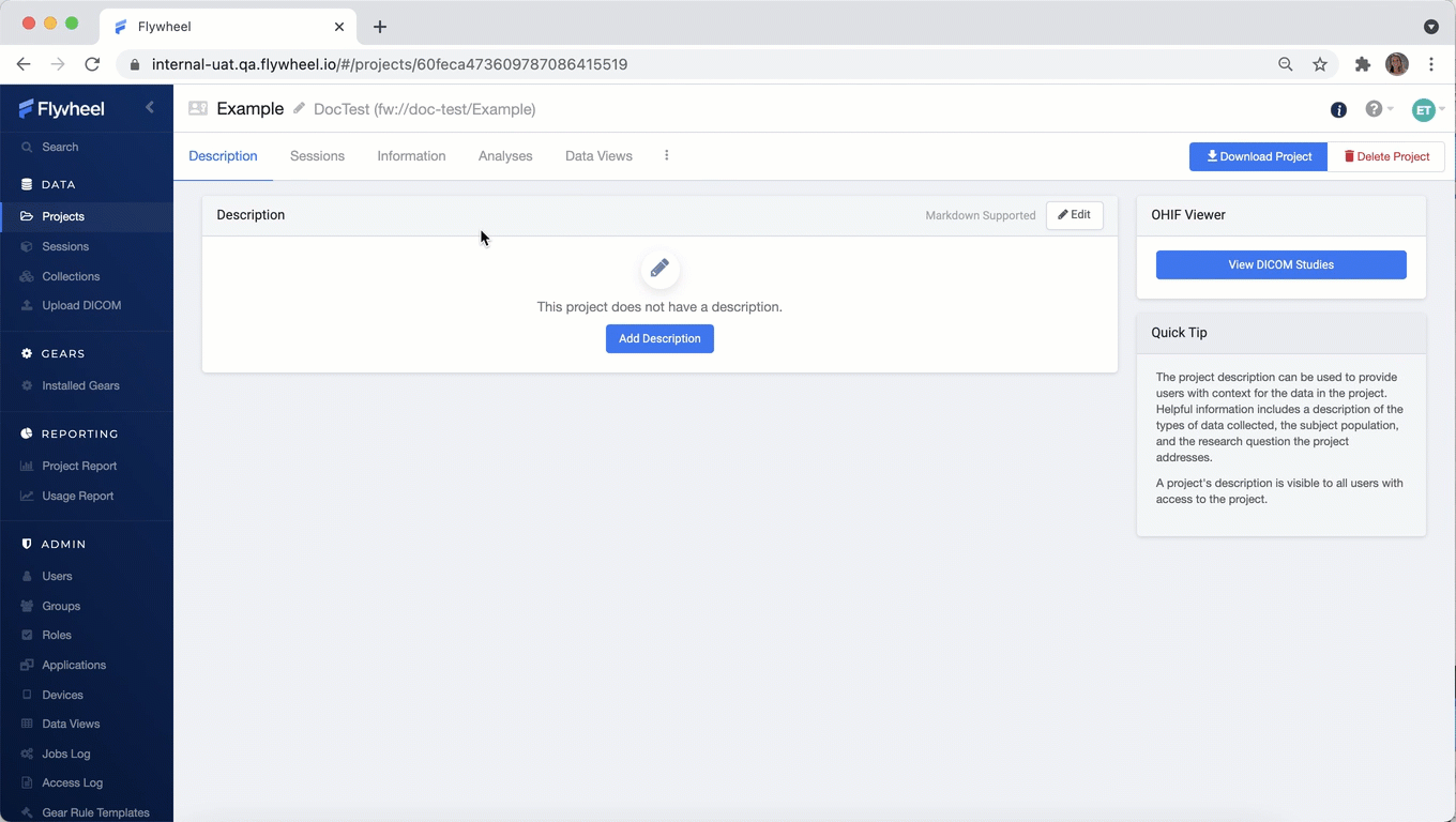 Detecting Duplicate Files With Fw Ingest Flywheel Documentation - Gradient Designs - Modern 8K Collection