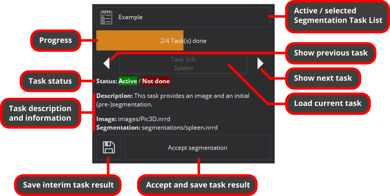 Mitk Segmentation Redesign Mitk Org - Ocean Photo Collection - Retina Quality