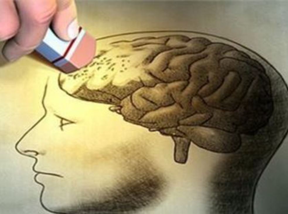 The Unusual Link Between Alzheimer's and Coconut Oil