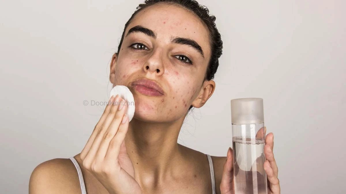 Acne Skincare Routine