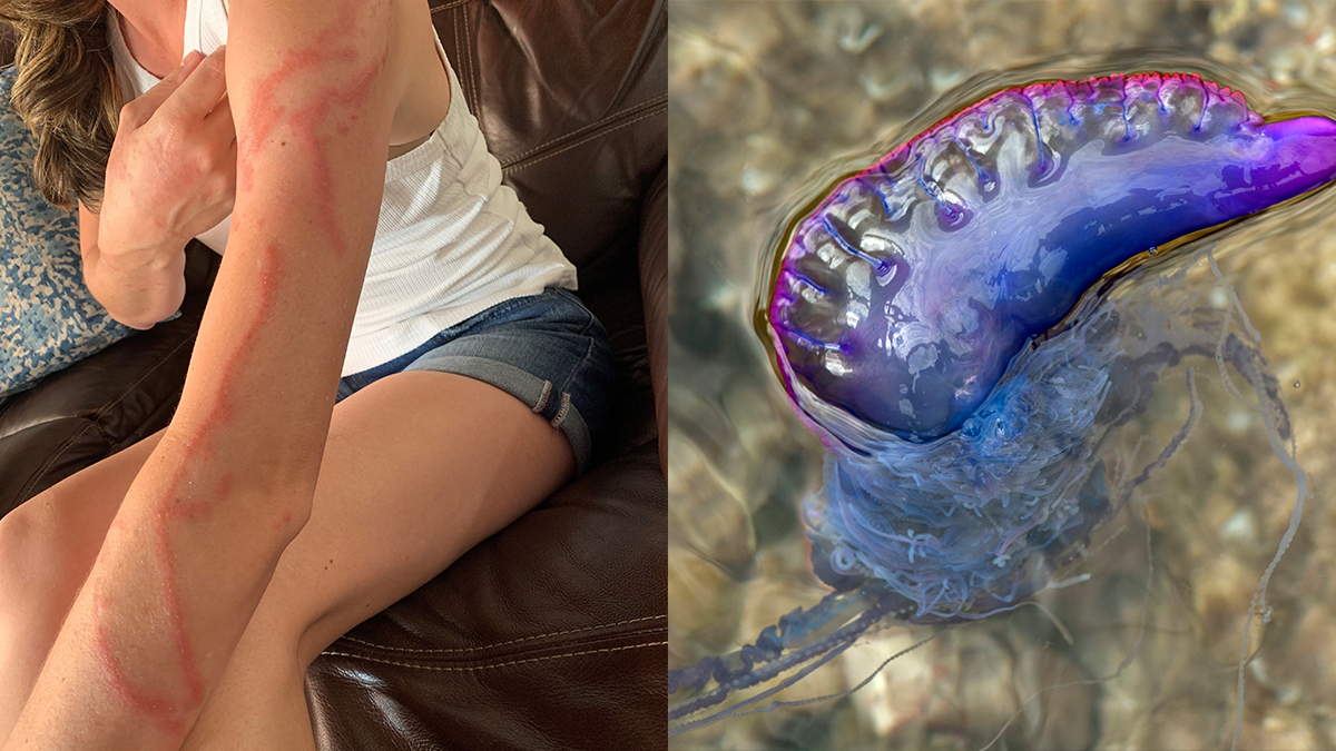 Portuguese man o’ war