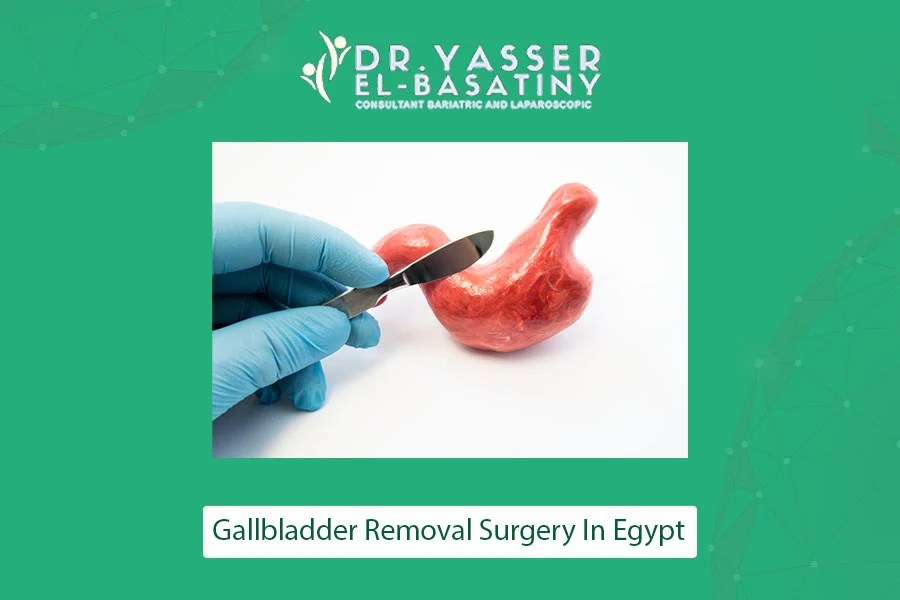 Gastric bypass vs gastric sleeve