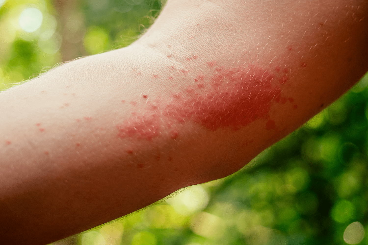 DRA. RAMIREZ SERVICES-SKIN LESIONS