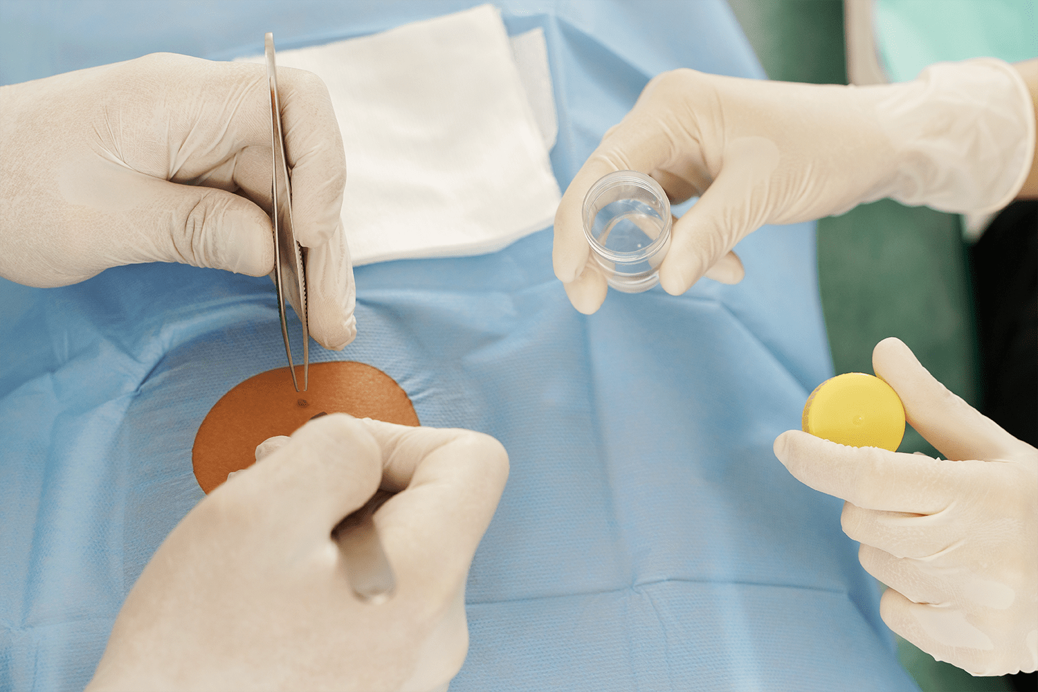 DRA. RAMIREZ SERVICES - CANCER SURGERY