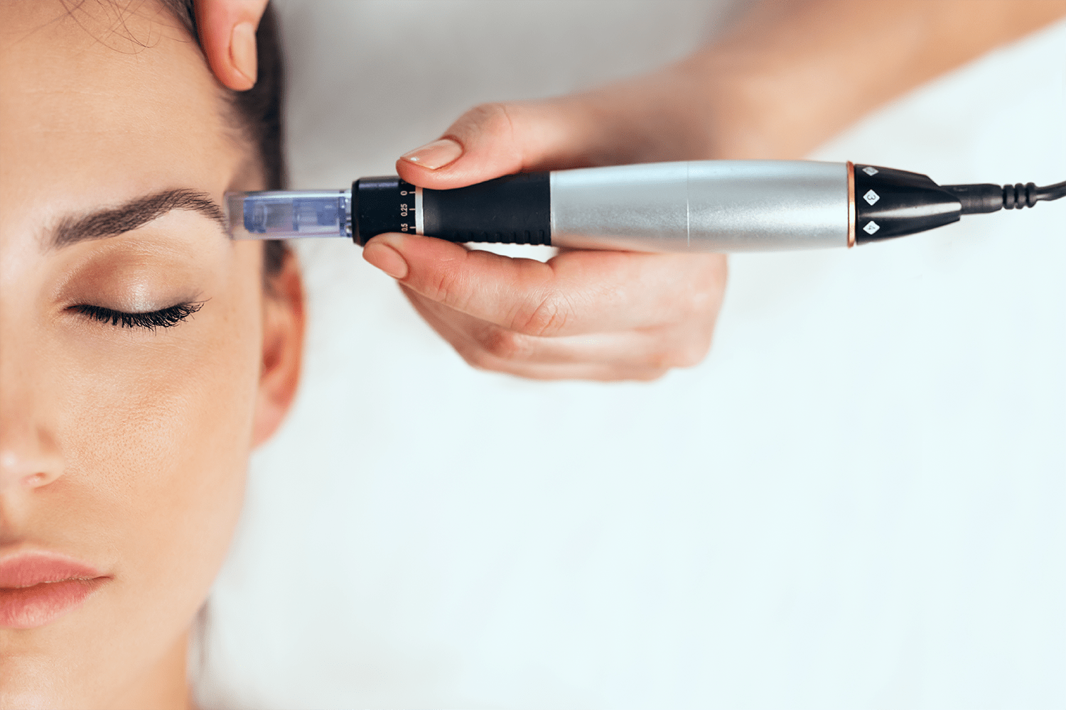 DRA. RAMIREZ SERVICES - MICRONEEDLING