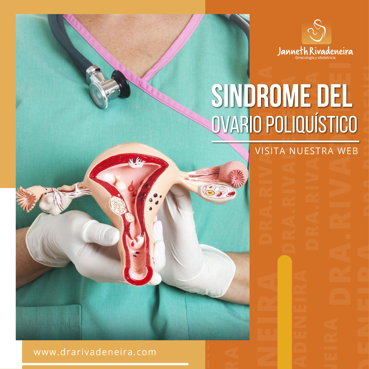 Sindrome De Ovario Poliquistico Ginecologa En Quito