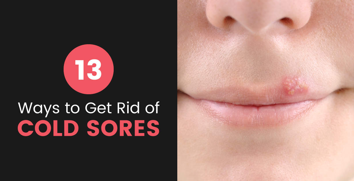 · keep the area moisturized. Cold Sores How To Get Rid Of Cold Sores Naturally Dr Axe