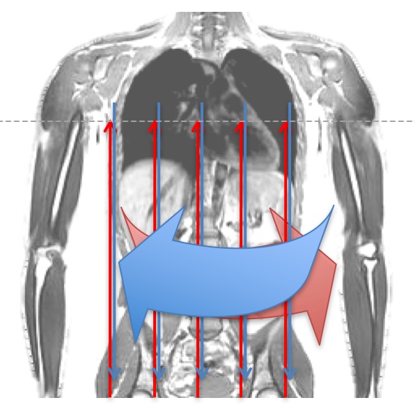 Induced fields, MRI safety