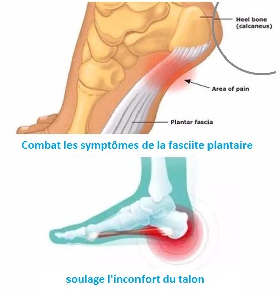 chaussettes magnetiques magnetosocks 3