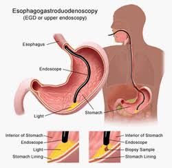 Endoscopy