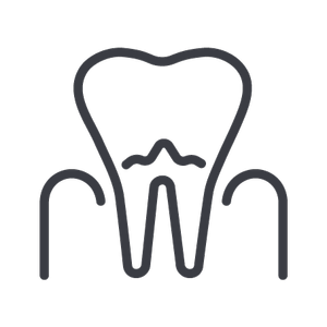 Tooth with gum disease illustration, advanced periodontal disease treatment.