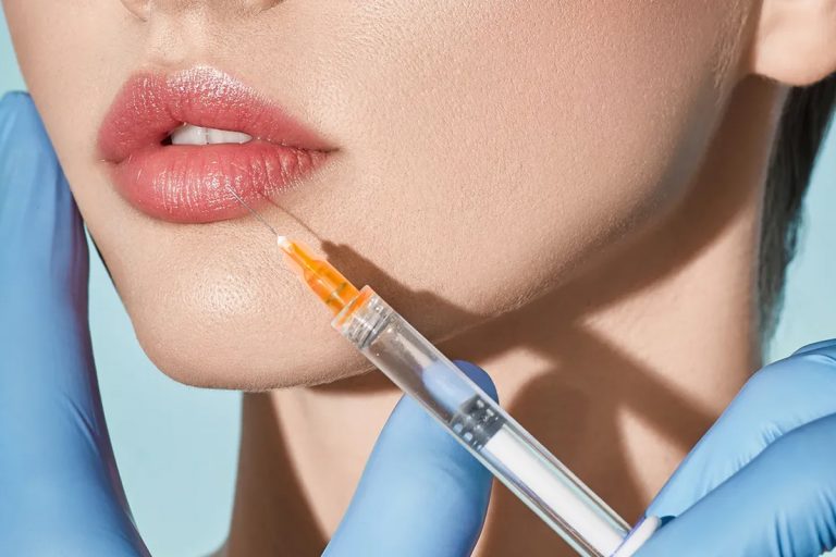 Lip Enhancement