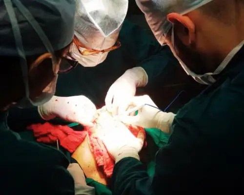 operation (1)