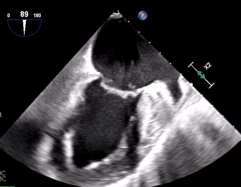 Pacemaker Dr Mark Perrin - Download Stunning Ocean Image | Mobile