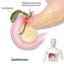 laparoscopic gall bladder surgery