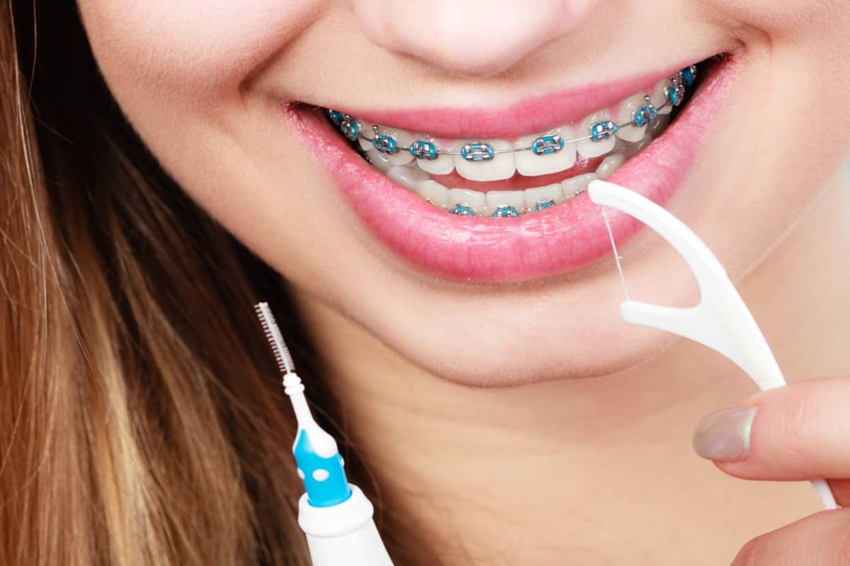20.09.2021 · if you have to brush your teeth after breakfast, try to wait 30 to 60 minutes before you brush. How to Brush and Floss with Braces - Portalupi Orthodontics