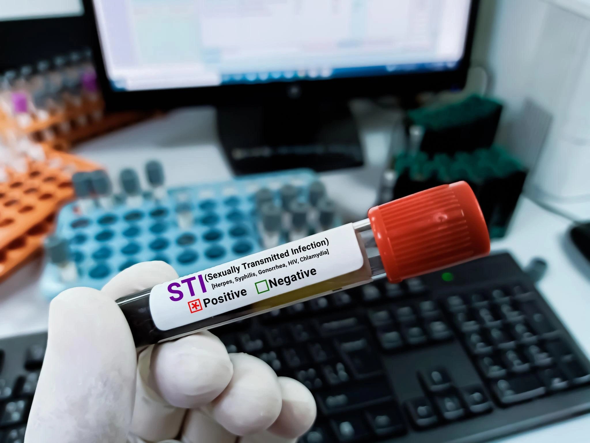 Penyakit STD