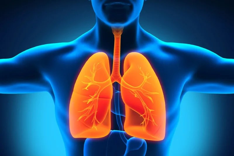 Pneumothorax