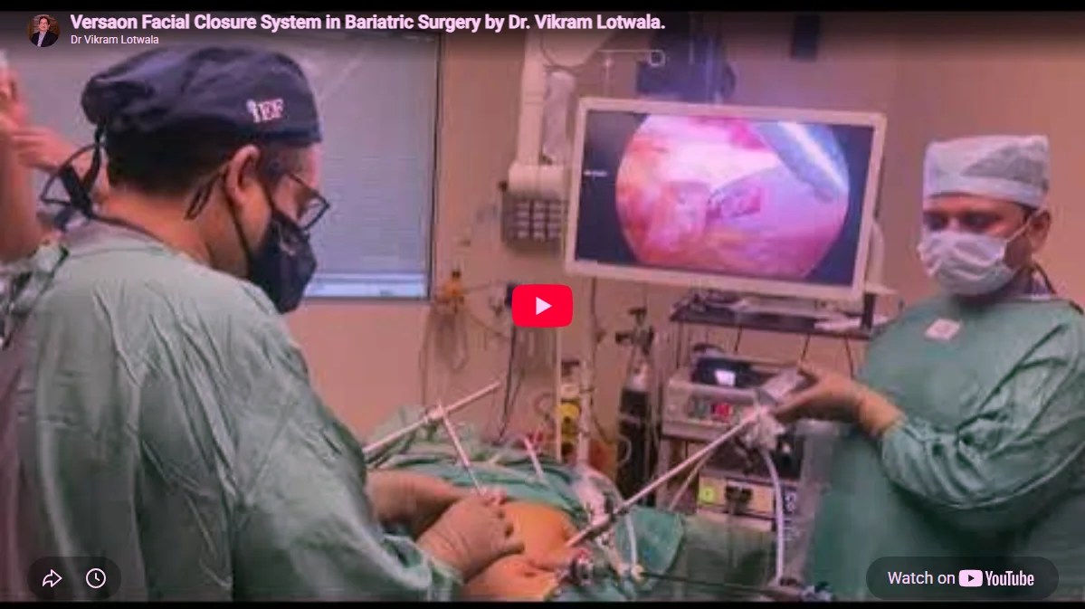 Versaon Facial Closure System