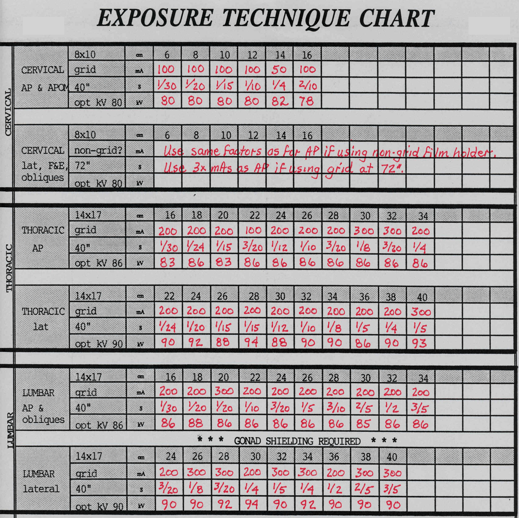 x-ray exposure chart