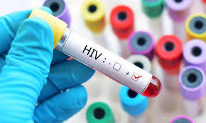 Is There A Cure For HIV Yet? #NO