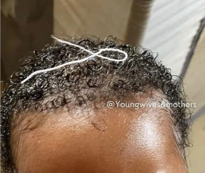 Ǹjẹ́ fífi òwú sí àwùjẹ̀ ọmọdé lè dẹ́kun èsúkè?