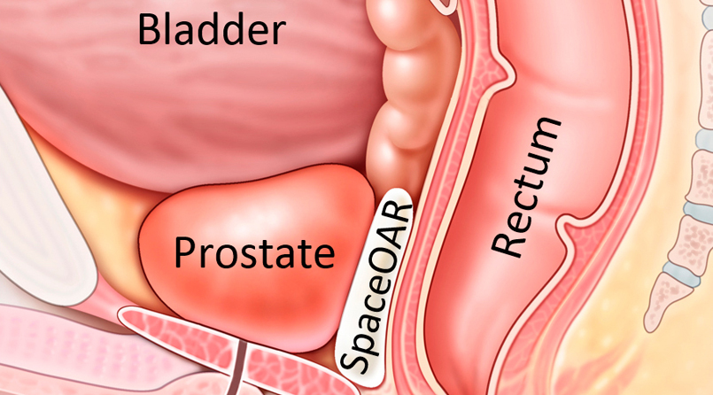 Misleading! Cucumbers, onions, tomatoes, not prostate cancer cure
