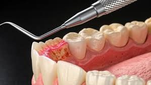 Can pear and alcohol mixtures cure toothaches?