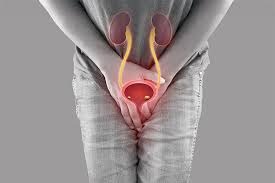 No, mixture of lemon, garlic, onion doesn’t cure UTI