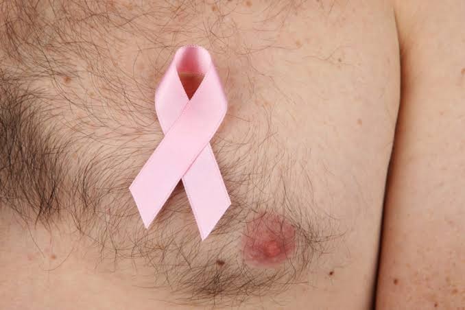 Image used to represent breast cancer in men. Picture source: BJMO.