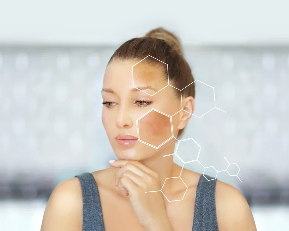 Habit Hack Guide To Hyperpigmentation Duogen