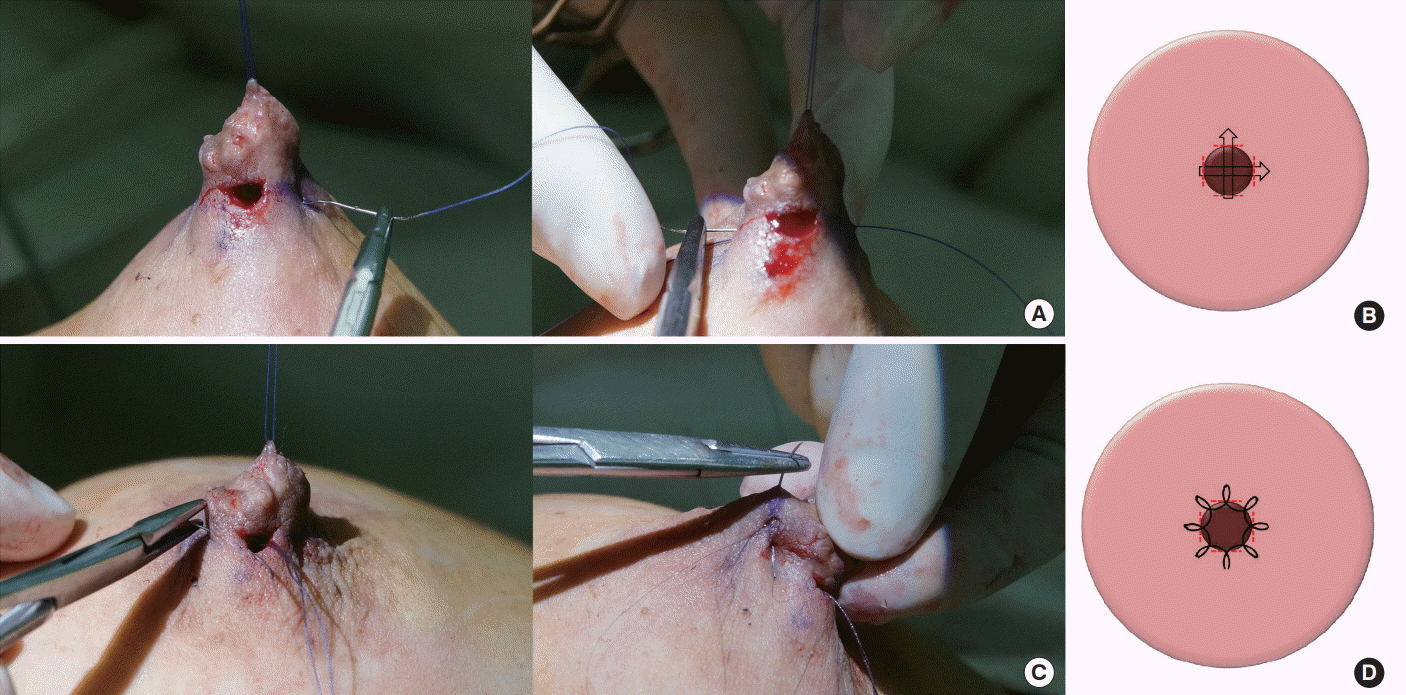 Archives of Aesthetic Plastic Surgery