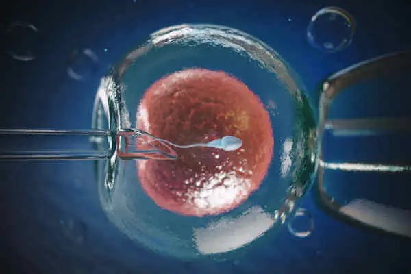 In-vitro fertilization