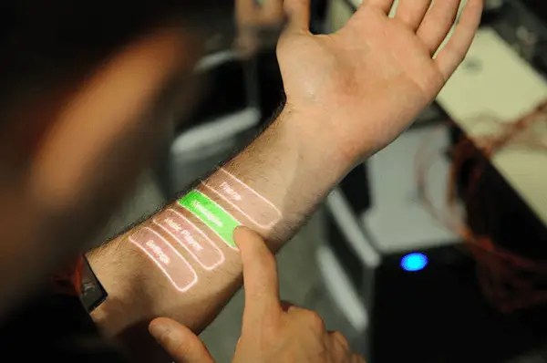 implanted microchips