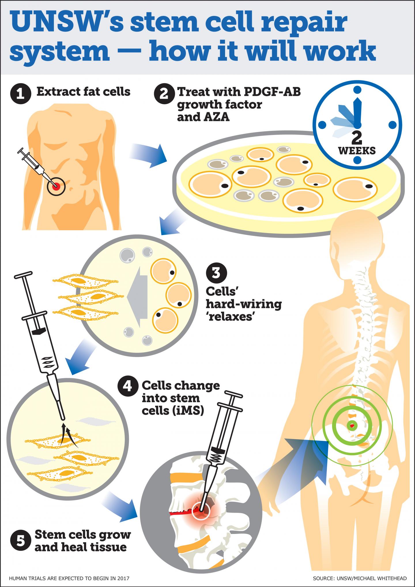 Australian scientists develop 'game changing'