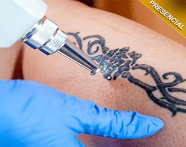 Clinica para tirar tatuagem proximo nove de julho Barbara Evans Mostra Resultado Da Remocao De Suas Tatuagens Pro Corpo