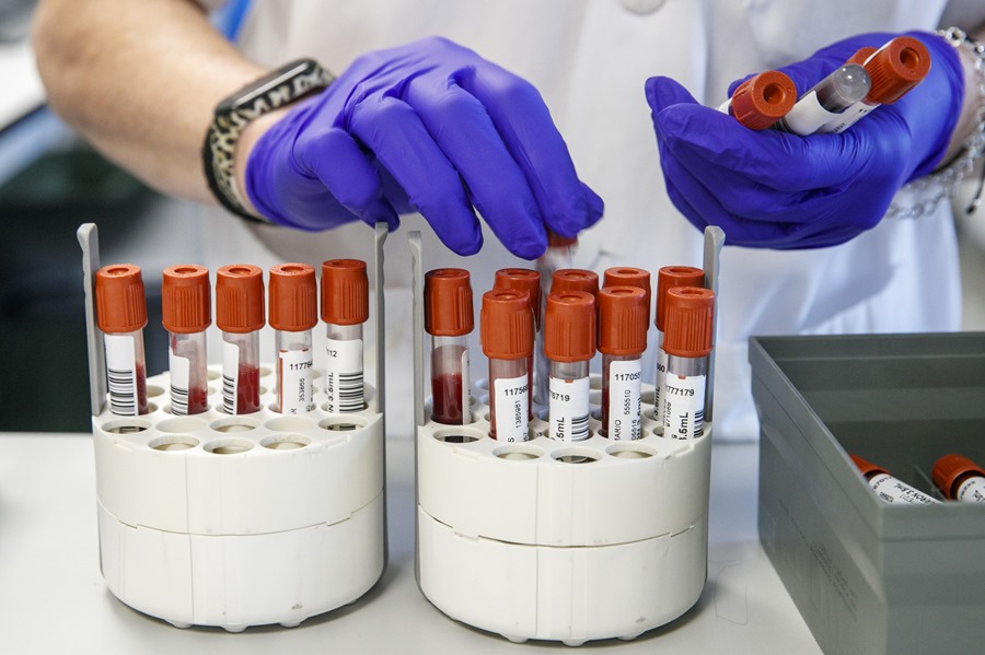 Personal técnico de laboratorio prepara unas muestras para analizar, en una imagen de archivo.