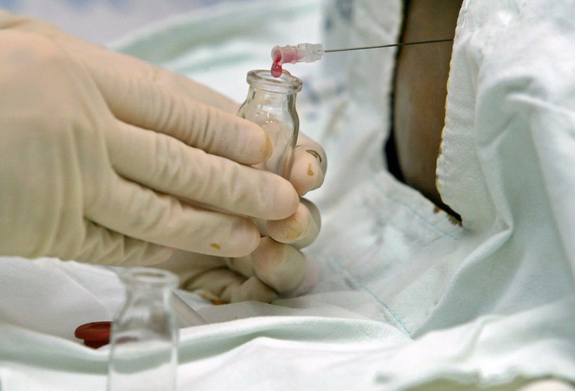 Un total de 1.744 personas se registraron como donantes potenciales de médula ósea el año pasado en Extremadura, un dato que sitúa a la región con "líder" en el ámbito nacional y que eleva a más de 16.000 la cifra de ciudadanos dispuestos "a regalar vida".